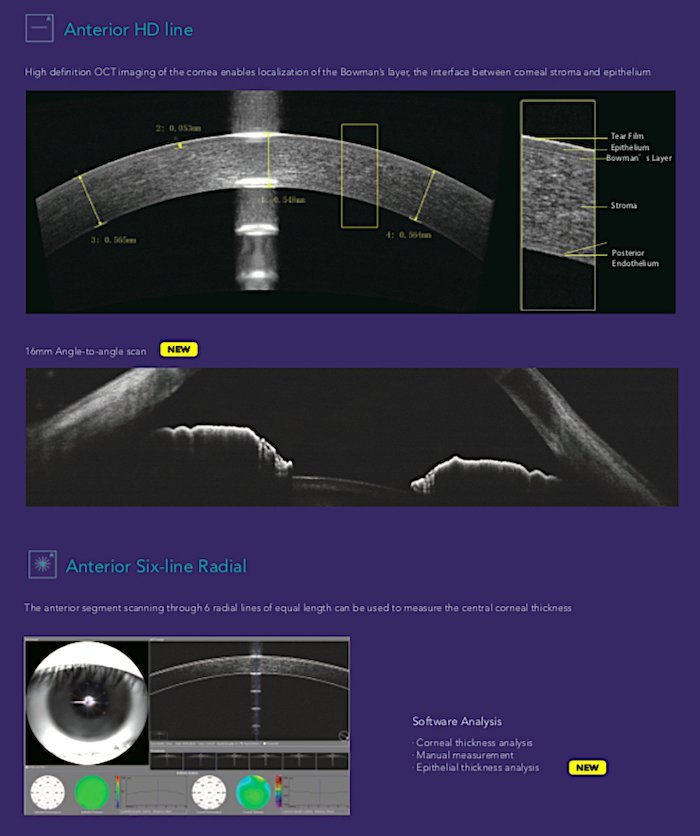 Tomografia coerenza ottica_Mocean_4000_7_Dr. Alberto Bellone