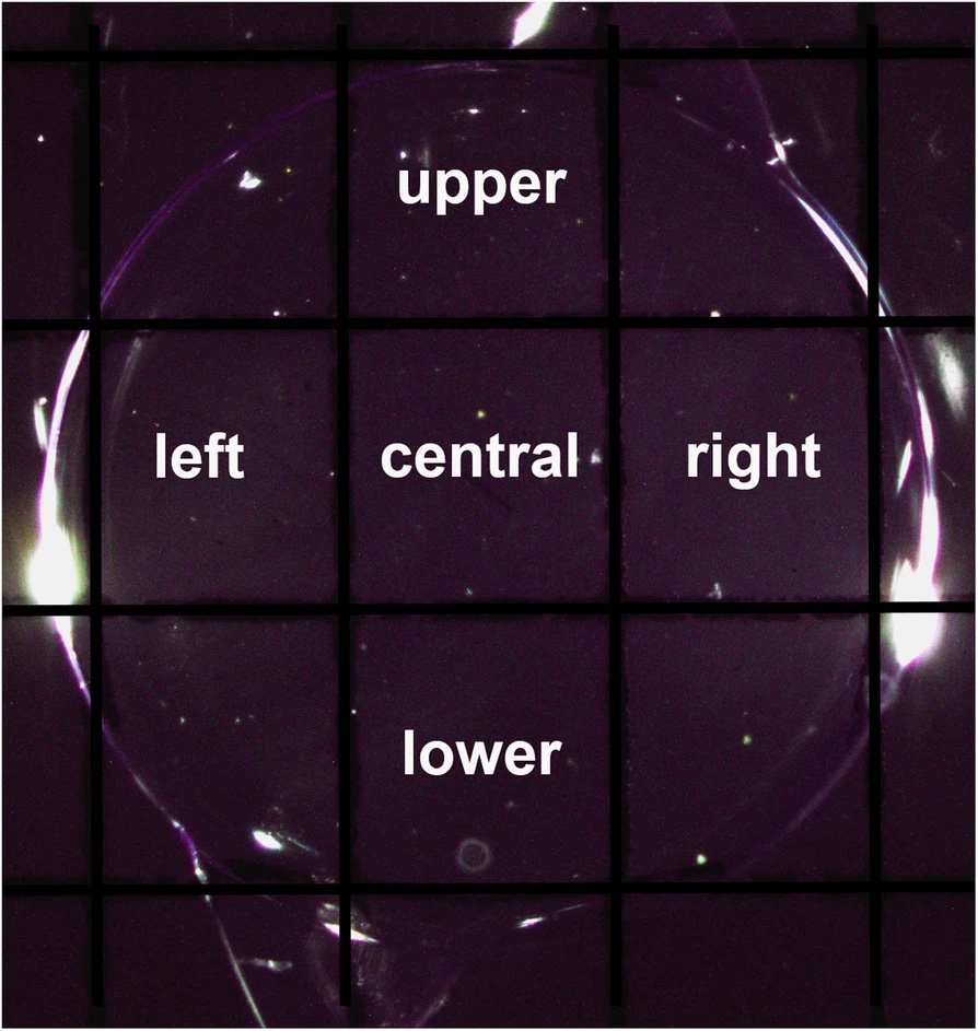 Intraocular lens optic sectioned by a standard grid