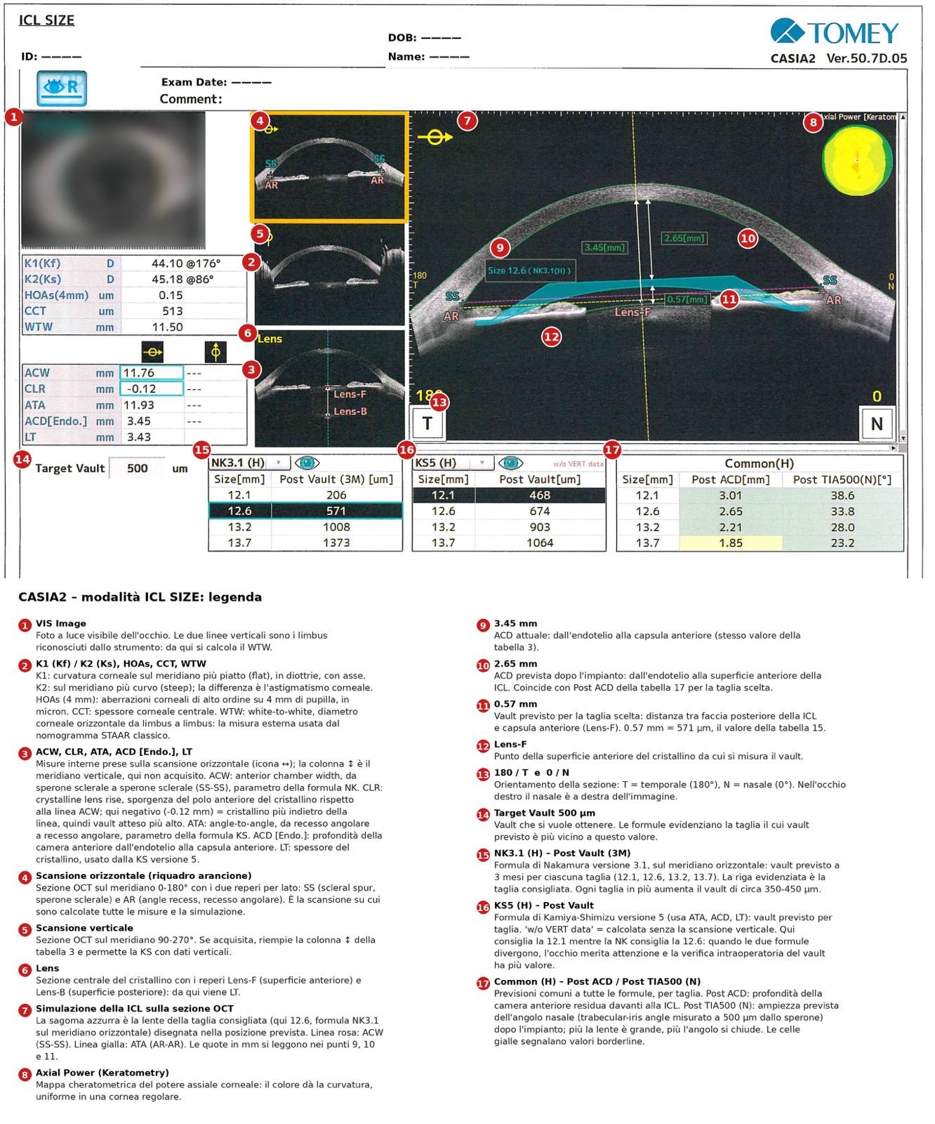 Schermata ICL SIZE del CASIA2 con la legenda delle misure: ACW, CLR, ATA, ACD e vault previsto per le quattro lunghezze di ICL